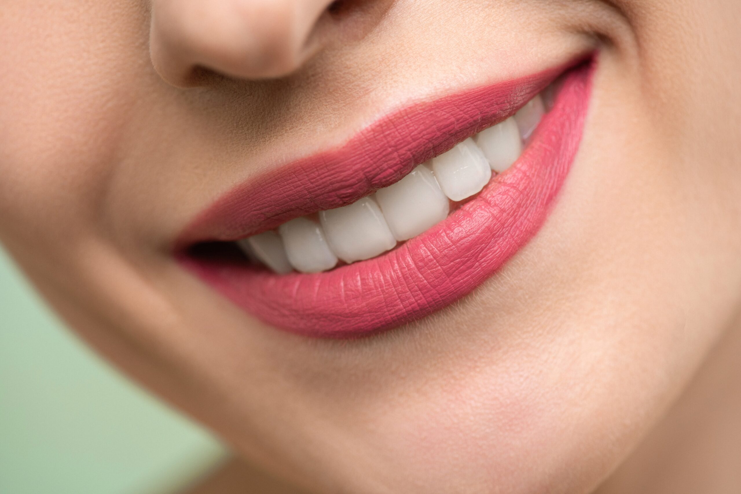 White fillings