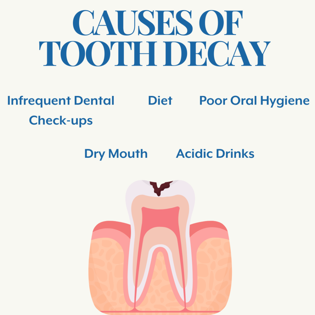 causes of tooth decay
