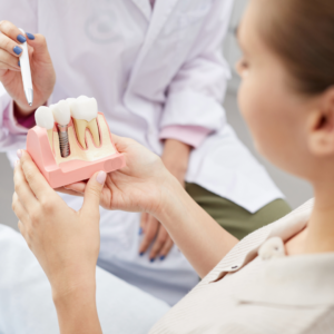 Dental Implants