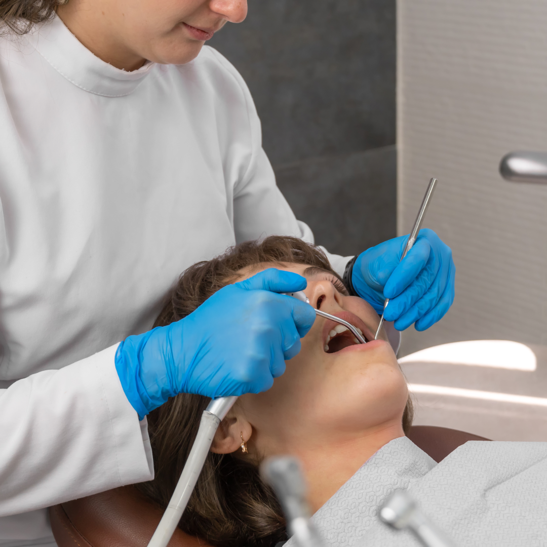 Air Polishing: The Modern Way to Clean Teeth