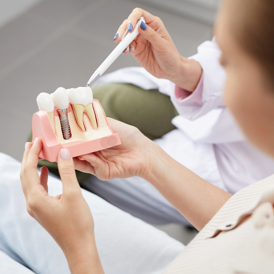 Dental Implants vs Dentures