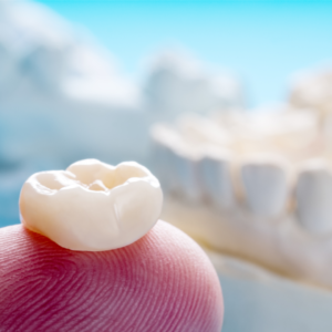 Dental Crowns